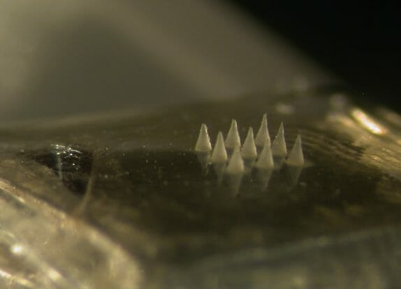 Microneedles Hydrogel Formulation